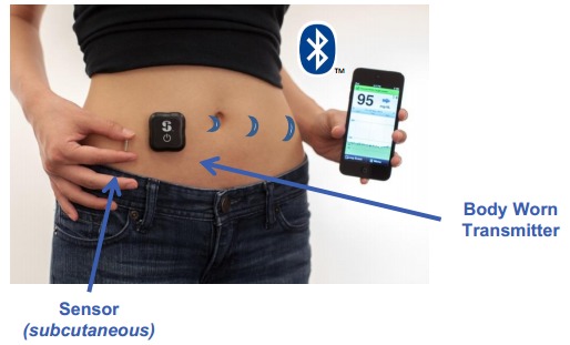 Roche i Senseonics CGMS