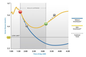 SmartGuard - prediktivno isključivanje inzulina