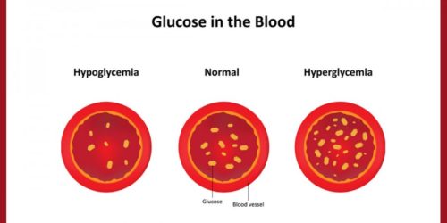 Što nam hipoglikemija uistinu čini?