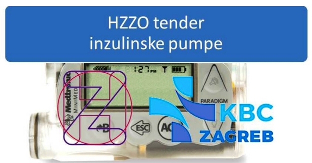 Rebro je službeno preuzelo HZZO tender za inzulinske pumpe