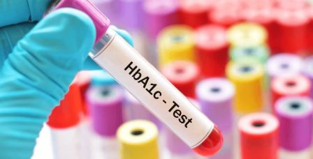 HbA1c se više ne mora nužno mjeriti iz venske krvi