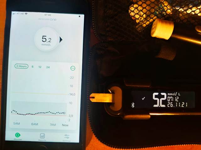 Moji rezultati - usporedba Dexcom ONE sa krvlju