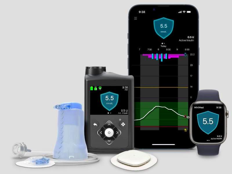 Medtronic 780G sa povezanim Simplera senzorom, mobitelom, satom i infuzijskim setom