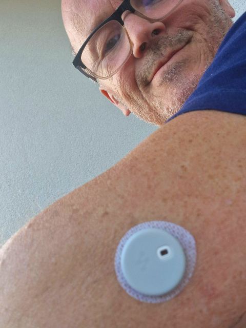 Syai tag senzor za dijabetes