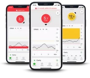 Dexcom alarmi