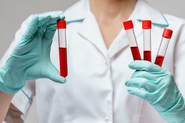 ampule krvi za testiranje