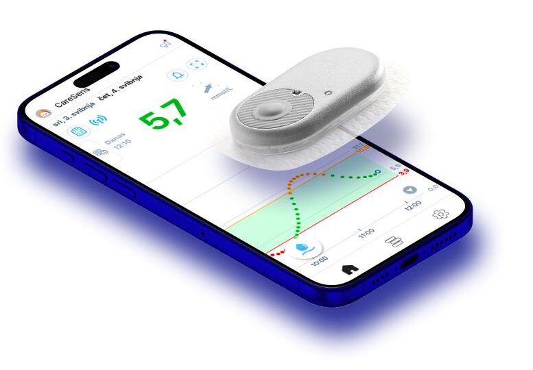 CareSens Air CGM aplikacija i senzor