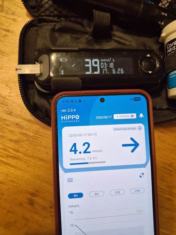 Usporedba Hippo CGM senzora i krvi kod nižih vrijednosti (0,3 razlike)
